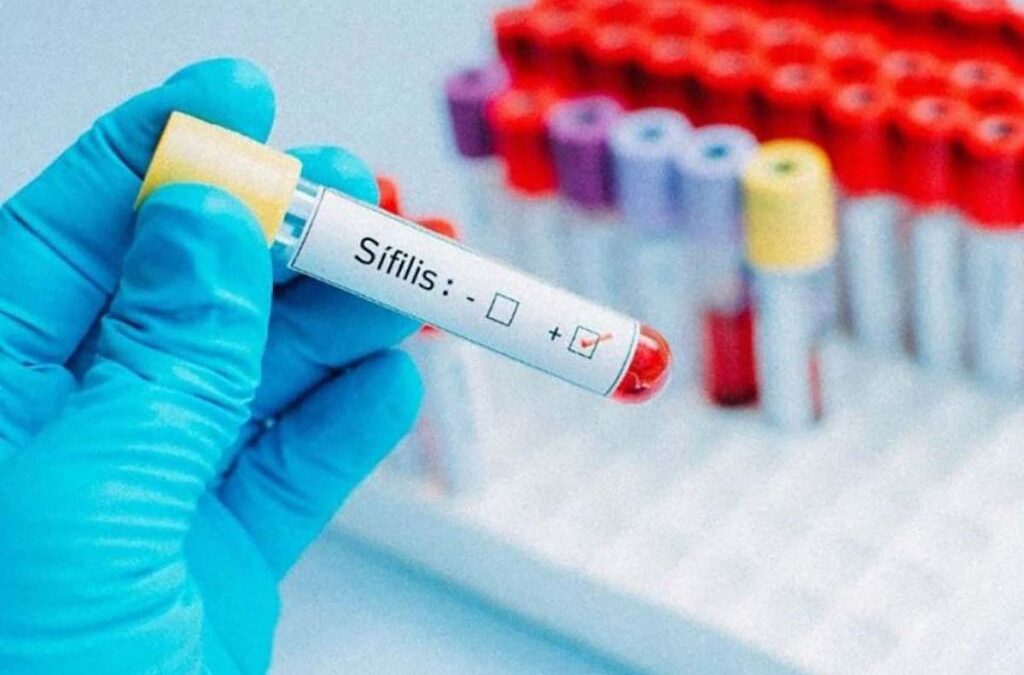 Incrementan Testeos Rápidos, Gratuitos y Confidenciales: sífilis, hepatitis y VIH